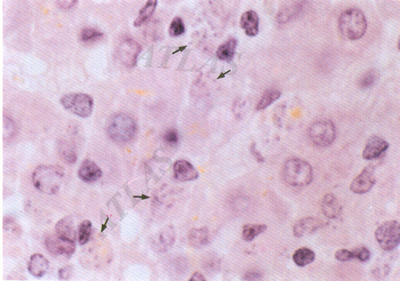 trypanosoma leishmania paraziták)