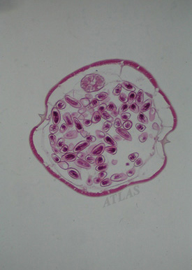 enterobius vermicularis függelék szövettana